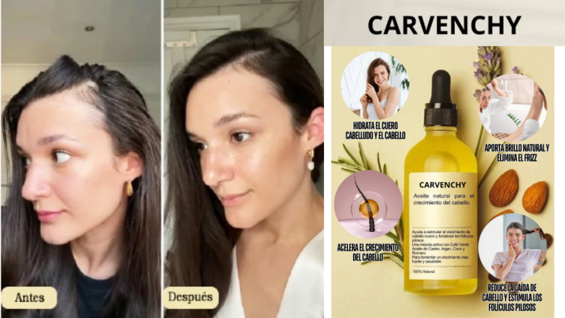 SERUM CAPILAR PARA EL CRECIMIENTO DEL CABELLO - CARVENCHY™