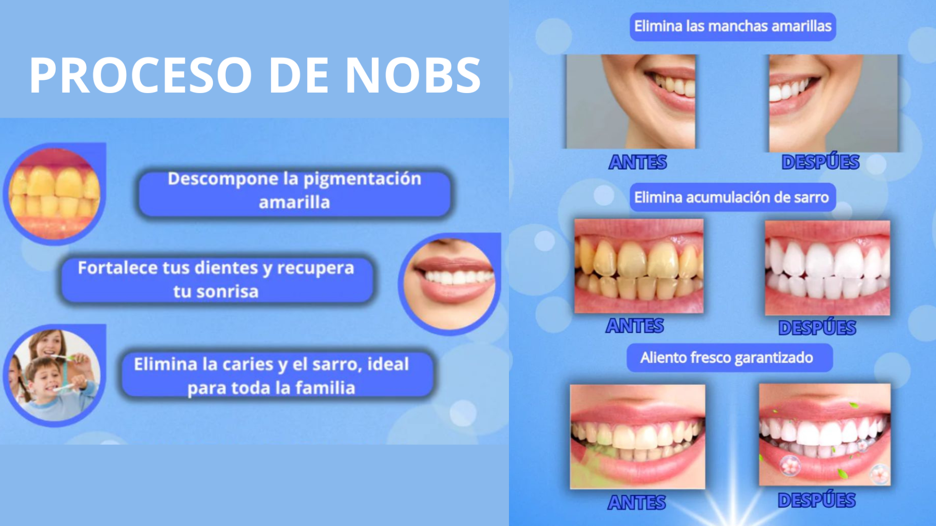 NOBS - PASTILLA MASTICABLE DENTAL